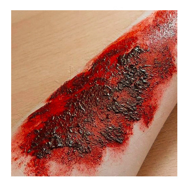 Burn paste