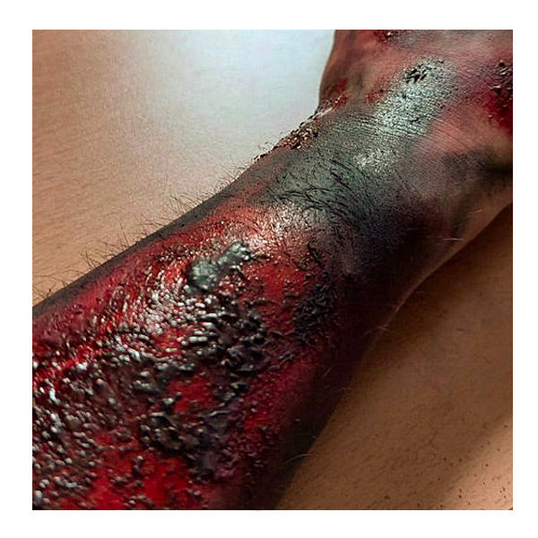 Burn paste